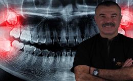 YİRMİLİK DİŞLER İHMALE GELMİYOR! UZMANI UYARDI: GÜLÜŞÜNÜZ BOZULABİLİR