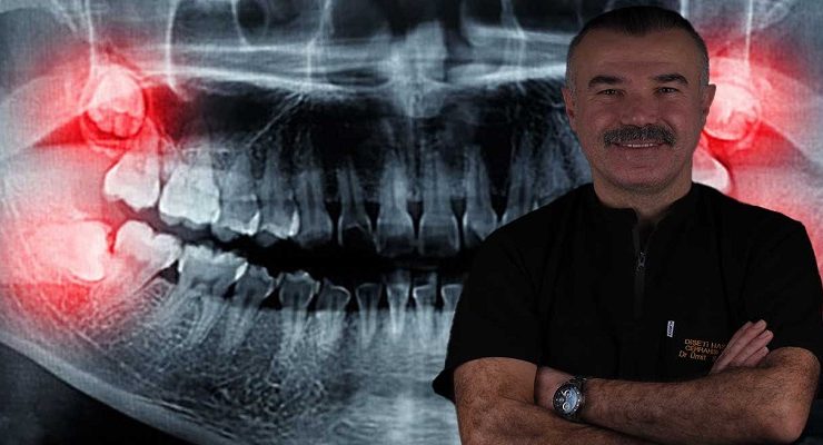 YİRMİLİK DİŞLER İHMALE GELMİYOR! UZMANI UYARDI: GÜLÜŞÜNÜZ BOZULABİLİR