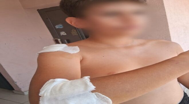KUMBAĞ’DA SOKAK KÖPEĞİ ENDİŞESİ: VATANDAŞLAR TEDİRGİN