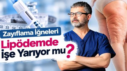 lipödem_084457347